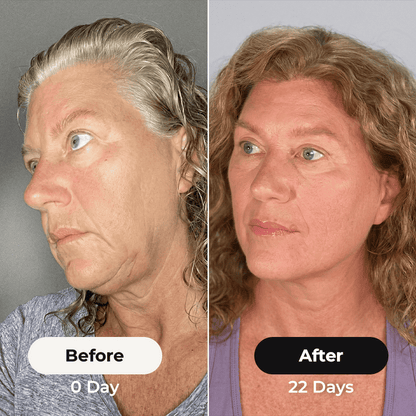 El cepillo para rizos™