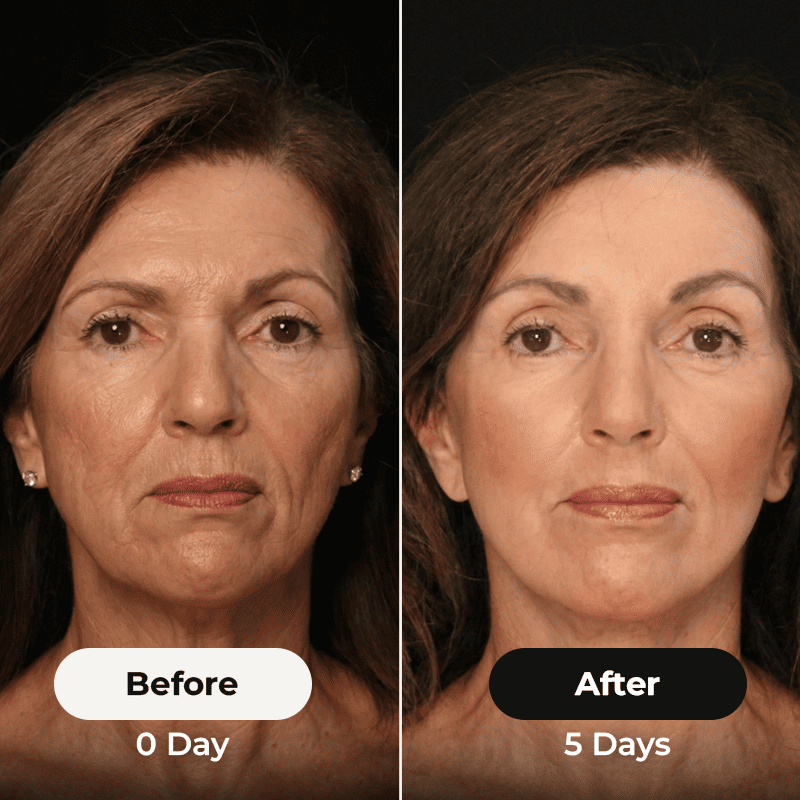 El cepillo para rizos™