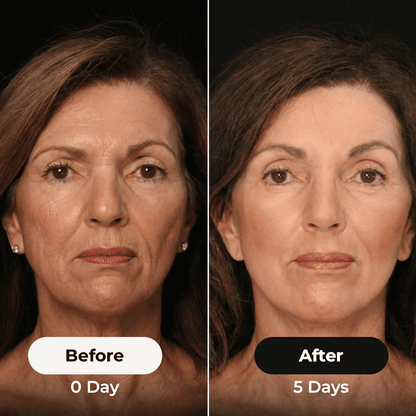 El cepillo para rizos™